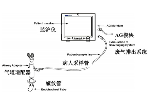 先锋科技探测器、光学元件为麻醉气体浓度监测提供解决方案